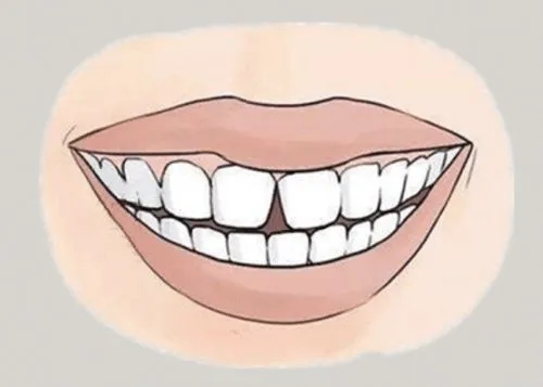 <a href=http://nfrzbj.cn/news_article?news_id=116>一次性口腔探針</a>